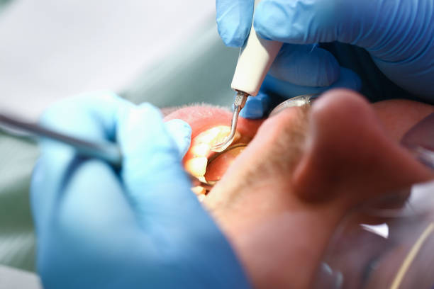 Best Emergency Treatment for Oral Infections in Roosevelt Park, MI